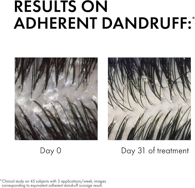 Vichy Dercos Anti Dandruff Shampoo for Dry hair 390ml