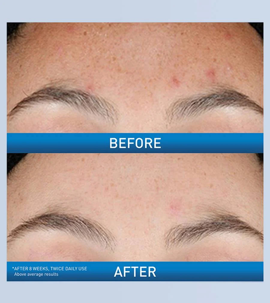 CeraVe Resurfacing Retinol Serum 30ml